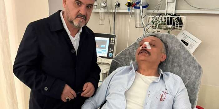 Makam Odasında Saldırıya Uğrayan Okul Müdürünün Burnu Kırıldı